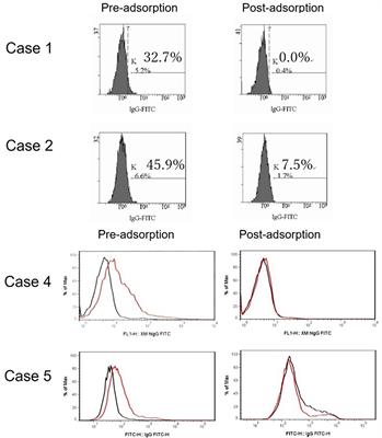 CASE REPORT: Serial Cases of False-Positive Flow-Cytometry T Cell Crossmatch Associated With Anti–Blood Type Antibodies in Patients Undergoing ABO-Incompatible Kidney Transplantation